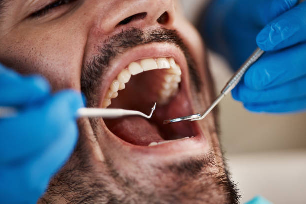 Tooth Infection Emergency Dentist in LA