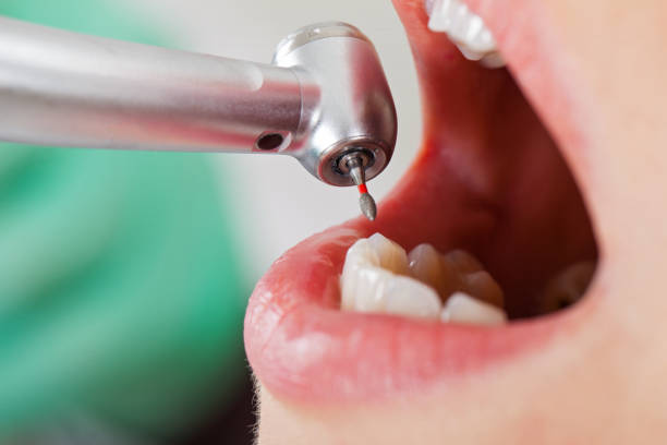 Best Broken Tooth Emergency  in Prairieville, LA